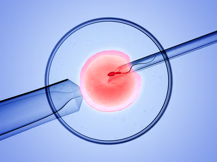 Which Insurance Covers IVF in India? A Comprehensive Guide 36 Insurance Covers IVF in India?